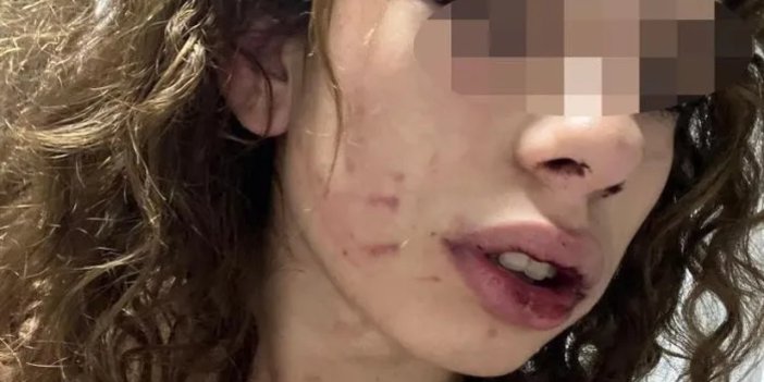 Konya'da dehşet verici olay! Üniversiteli genç kıza saatlerce işkence etti!