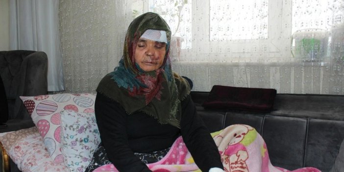 Aksaray'da anne ve baba, ziyarete gittikleri kızının köpeğinin saldırısına uğradı