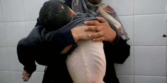 Gazze’de açlıktan ölenlerin sayısı 339’a çıktı