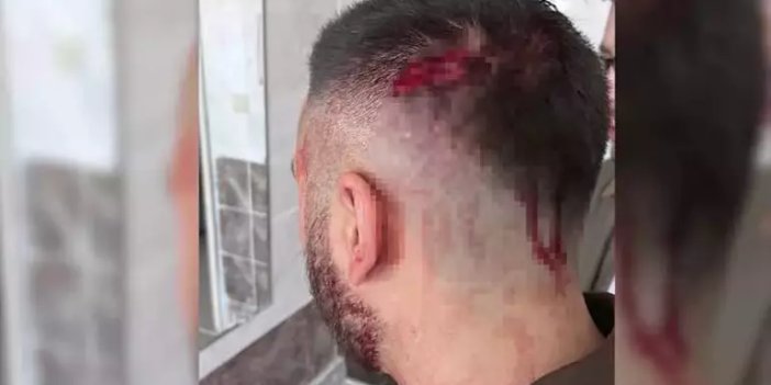 Öğretmene okulda demir sopalı saldırı