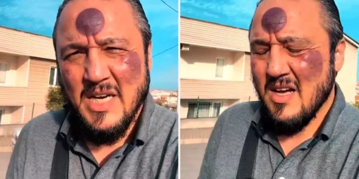 Yüzüne yaptırdığı işlemden sonra bu hale geldi, yine de savundu