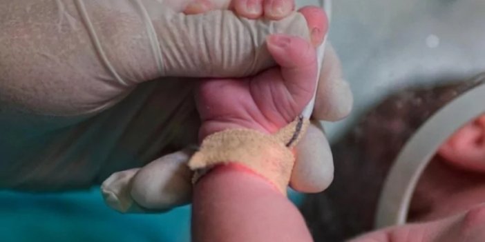 Yenidoğan tedavileri artık bu yöntemle belirlenecek