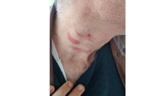 Konya’da aile hekimine saldırı