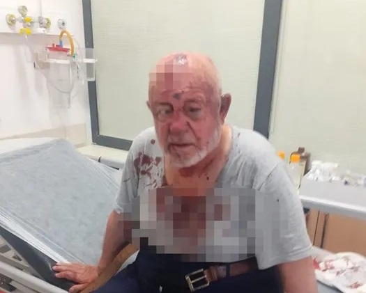 Konya'da kira nedeniyle vakıf başkanını öldüresiye dövdüler