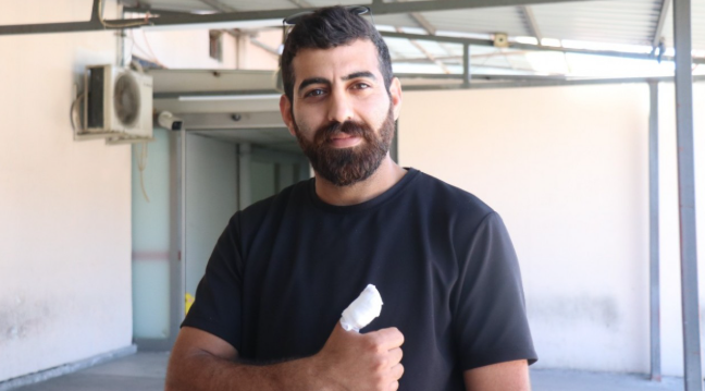 Acemi kasaplar acilleri doldurdu: ''Amca beni yaktın''