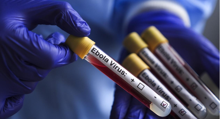 İsrail'de ilk kez Ebola şüphesiyle bir kişi karantinaya alındı