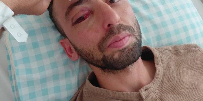 Konya’da gözünden vurulan temizlik işçisi konuştu